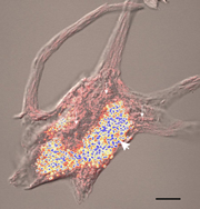 (A picture of lipofuscin)